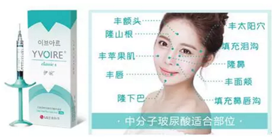 伊婉玻尿酸有幾個型號 伊婉c型和v型的區(qū)別 伊婉玻尿酸有幾個型號 伊婉c型和v型的區(qū)別