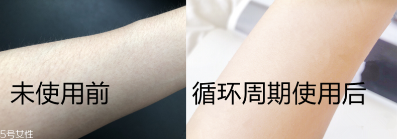 飛利浦脫毛儀不適合什么人使用 飛利浦脫毛儀不宜人群 飛利浦脫毛儀不適合什么人使用 飛利浦脫毛儀不宜人群