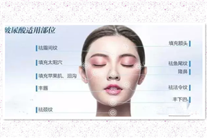 國產玻尿酸好嗎 國產玻尿酸哪些好 國產玻尿酸好嗎 國產玻尿酸哪些好