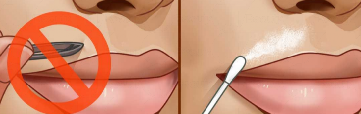 女生嘴上長小胡子怎么去掉 4種天然去除法 女生嘴上長小胡子怎么去掉 4種天然去除法