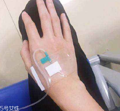 柴胡注射劑可以口服嗎？柴胡注射劑是口服藥品嗎？