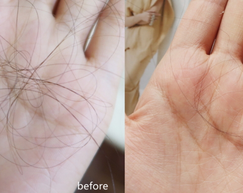 卡詩紅安瓶怎么樣？巴黎卡詩奇跡紅安瓶防脫效果