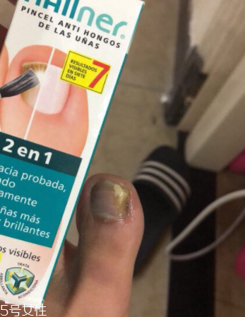 灰甲清有副作用嗎？灰甲清有哪些副作用？