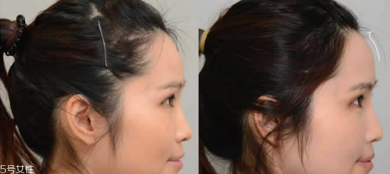 用修容粉怎么修飾發(fā)際線 用修容粉修飾發(fā)際線的簡單技巧 用修容粉怎么修飾發(fā)際線 用修容粉修飾發(fā)際線的簡單技巧
