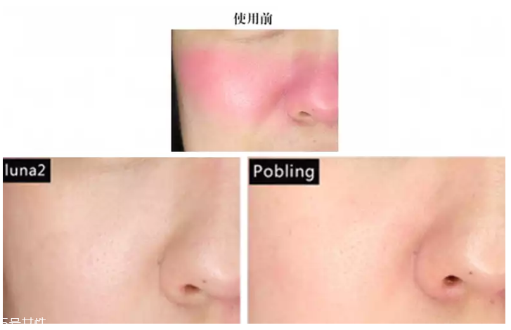 pobling和luna哪個(gè)好 pobling震動(dòng)潔面儀和luna mini2對比評測