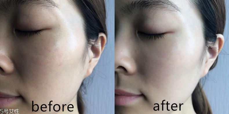 潤百顏玻尿酸一支能兩次用嗎 潤百顏玻尿酸效果好嗎 潤百顏玻尿酸一支能兩次用嗎 潤百顏玻尿酸效果好嗎