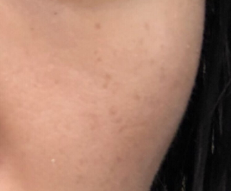 倩碧和蘭芝哪個檔次高？倩碧和蘭芝選擇