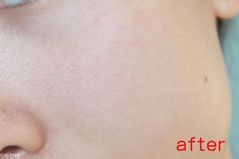 radha beauty vc精華白天能用嗎？敏感肌能用嗎？