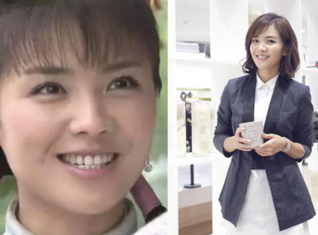 牙齒矯正會(huì)改變臉型嗎？矯正牙齒臉型變化圖