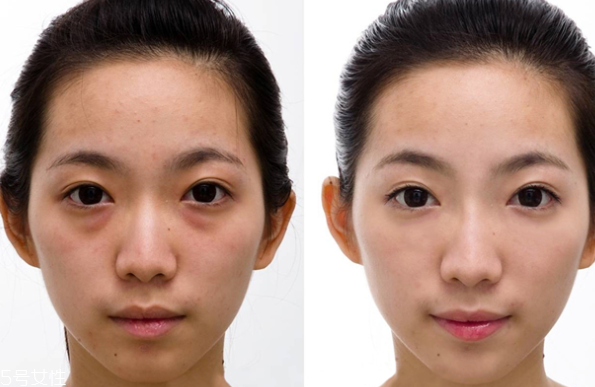 重度黑眼圈怎么遮瑕 熊貓眼遮瑕技巧 重度黑眼圈怎么遮瑕 熊貓眼遮瑕技巧