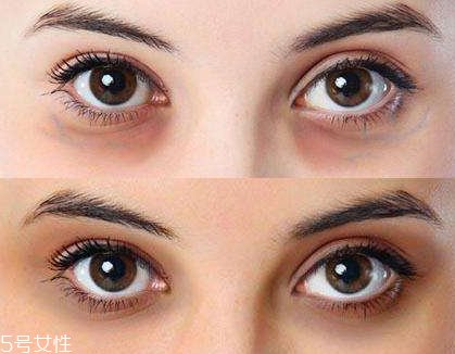 紅色黑眼圈怎么遮瑕 紅色黑眼圈用什么顏色遮瑕 紅色黑眼圈怎么遮瑕 紅色黑眼圈用什么顏色遮瑕