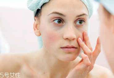 咖啡色黑眼圈怎么遮瑕 咖啡色黑眼圈用什么顏色遮瑕 咖啡色黑眼圈怎么遮瑕 咖啡色黑眼圈用什么顏色遮瑕