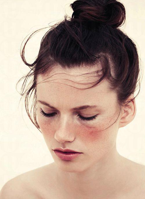 臉部各個部位干燥是什么原因 臉部各個部位干燥是什么原因