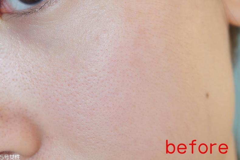 radha beauty vc精華白天能用嗎？敏感肌能用嗎？