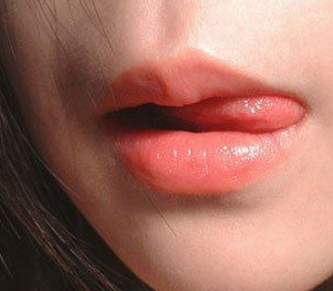 兔唇修復(fù)要多少錢？兔唇修復(fù)風(fēng)險大嗎