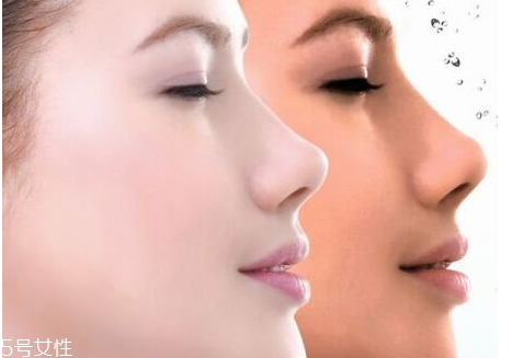 為什么臉色發(fā)黃暗沉 為什么臉色會暗黃 為什么臉色發(fā)黃暗沉 為什么臉色會暗黃