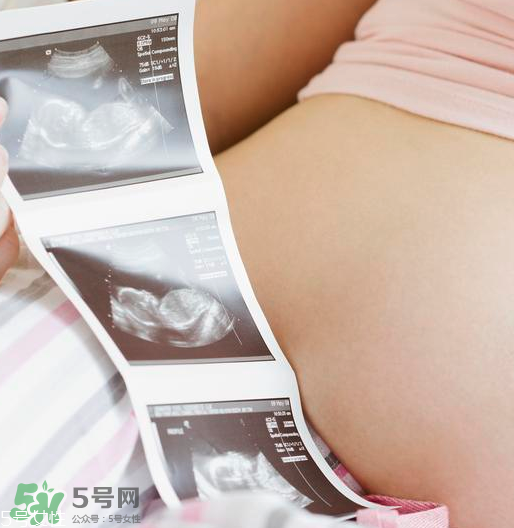 頭胎雙胞胎還能生二胎嗎？雙胞胎家庭能要二胎嗎？