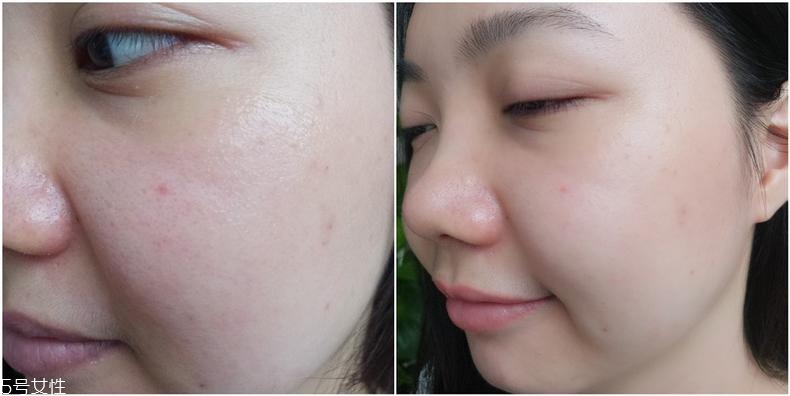 huxley仙人掌精華適合什么膚質(zhì) huxley精華3種膚質(zhì)評(píng)測(cè) huxley仙人掌精華適合什么膚質(zhì) huxley精華3種膚質(zhì)評(píng)測(cè)