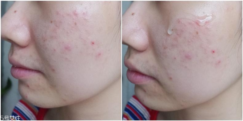 huxley仙人掌精華適合什么膚質(zhì) huxley精華3種膚質(zhì)評(píng)測(cè) huxley仙人掌精華適合什么膚質(zhì) huxley精華3種膚質(zhì)評(píng)測(cè)