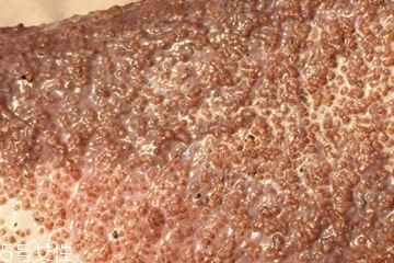 海藻面膜能去黑頭嗎？海藻面膜有去黑頭功效嗎？