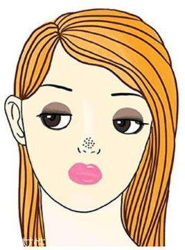 黑頭不管它會(huì)變大嗎？黑頭不管它會(huì)怎樣？