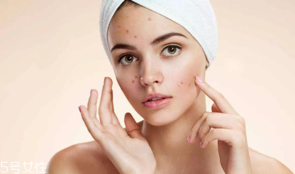 頑固痘痘怎么消除？油皮為什么反復(fù)爆痘？