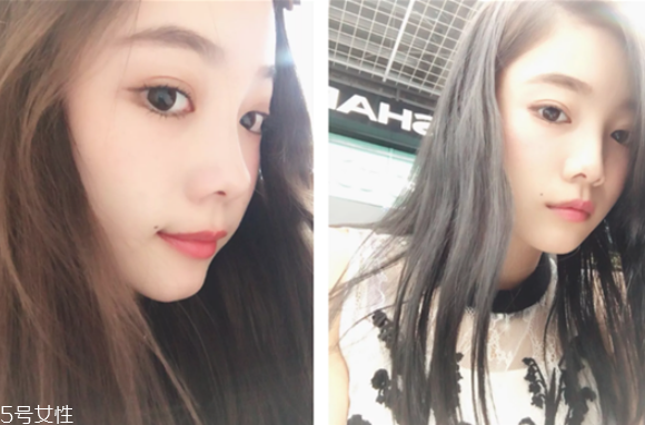 瘦臉針哪個(gè)牌子效果好 瘦臉針品牌排行榜 瘦臉針哪個(gè)牌子效果好 瘦臉針品牌排行榜