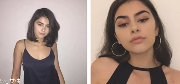 瘦臉針適合哪種臉型 瘦臉針適合多大年紀(jì)打 瘦臉針適合哪種臉型 瘦臉針適合多大年紀(jì)打