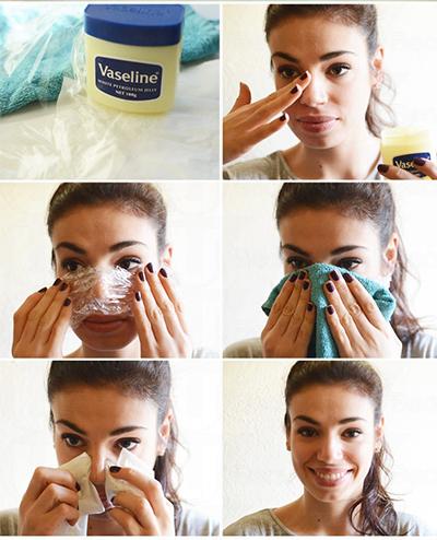 凡士林去黑頭小妙招 4步驟去除 凡士林去黑頭小妙招 4步驟去除