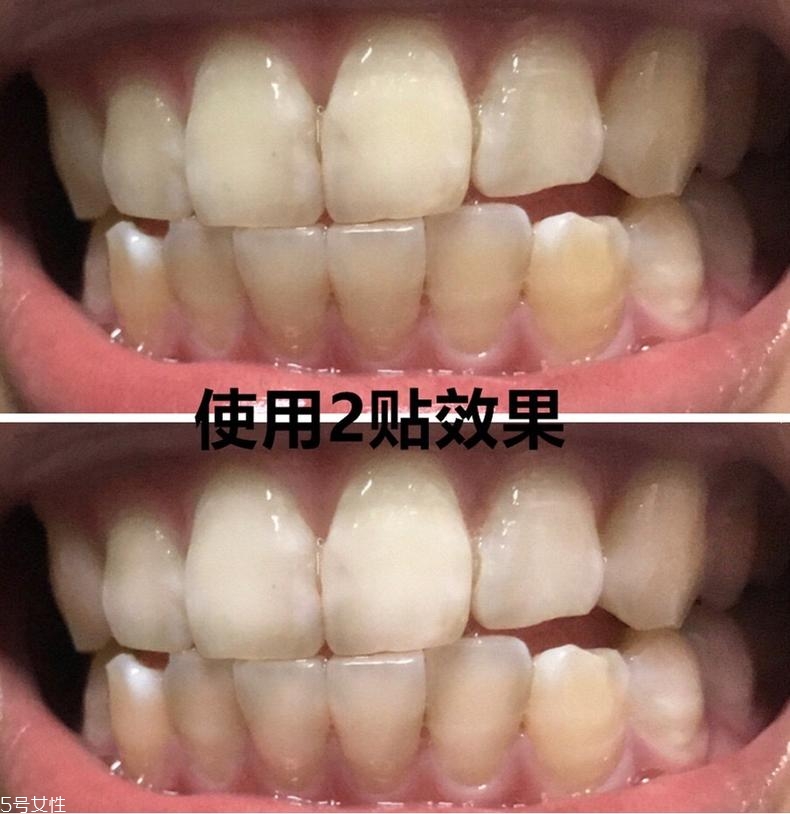 佳潔士美白牙貼貼多久有效？佳潔士美白牙貼使用感受