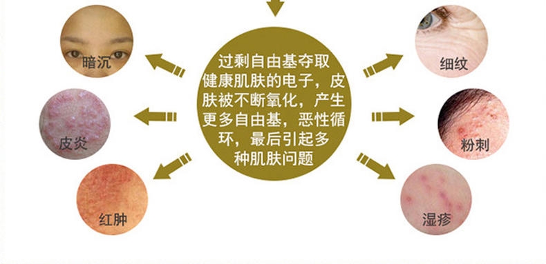 肌膚老化怎么預(yù)防最有效 把好這3道關(guān)是關(guān)鍵 肌膚老化怎么預(yù)防最有效 把好這3道關(guān)是關(guān)鍵