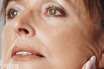 皮膚松弛怎么恢復(fù) 這樣預(yù)防皮膚松弛 皮膚松弛怎么恢復(fù) 這樣預(yù)防皮膚松弛