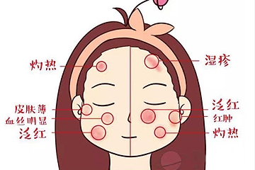 敏感肌用什么粉餅好 選對(duì)了不怕起痘 敏感肌用什么粉餅好 選對(duì)了不怕起痘