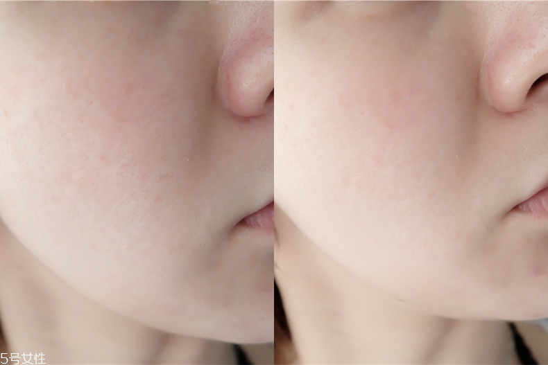 臺塑生醫(yī)產(chǎn)品不合格嗎 很安心的醫(yī)美級面膜 臺塑生醫(yī)產(chǎn)品不合格嗎 很安心的醫(yī)美級面膜