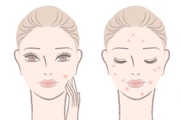 精華液什么成分能祛痘 挑對(duì)了令肌膚光滑如初 精華液什么成分能祛痘 挑對(duì)了令肌膚光滑如初