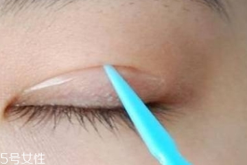雙眼皮貼和纖維條哪個(gè)好用 雙眼皮貼和纖維條哪個(gè)好用