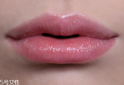 嘟嘟唇可以冰敷嗎 最好不要這樣做 嘟嘟唇可以冰敷嗎 最好不要這樣做