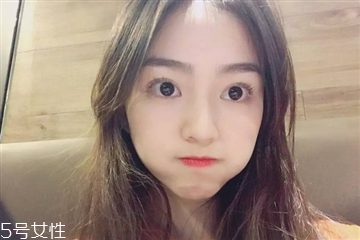 割完雙眼皮充血怎么辦 屬于正?，F(xiàn)象