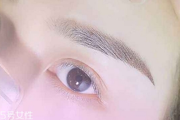 紋眉為什么會(huì)結(jié)痂 因?yàn)橛袀诎? alt=