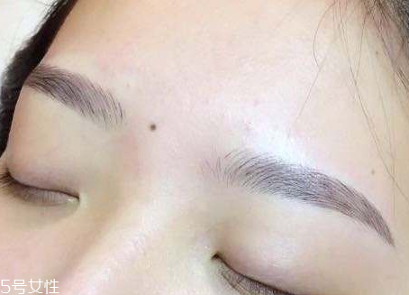 紋眉為什么不能吃海鮮 發(fā)物都不能吃 紋眉為什么不能吃海鮮 發(fā)物都不能吃