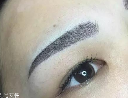 紋眉為什么不能吃海鮮 發(fā)物都不能吃 紋眉為什么不能吃海鮮 發(fā)物都不能吃