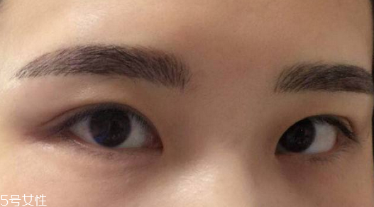 紋眉需要打麻藥嗎 沒這個必要