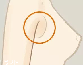 假副乳和真副乳的區(qū)別 前者能快速消除 假副乳和真副乳的區(qū)別 前者能快速消除