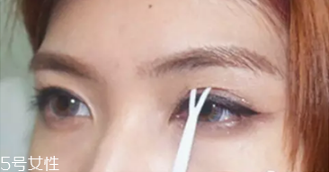 納米無痕雙眼皮是埋線嗎 納米無痕雙眼皮介紹 納米無痕雙眼皮是埋線嗎 納米無痕雙眼皮介紹