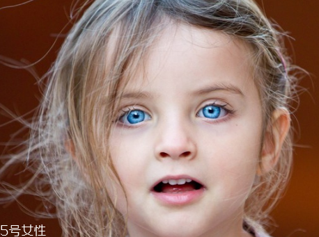 開眼角會不會留疤痕 開眼角疤痕增生原因 開眼角會不會留疤痕 開眼角疤痕增生原因