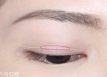 蕾絲雙眼皮貼怎么用 貼法不當效果大打折扣 蕾絲雙眼皮貼怎么用 貼法不當效果大打折扣