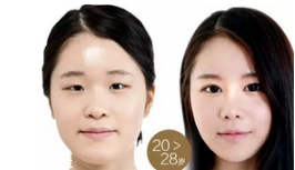 蕾絲雙眼皮貼怎么用 貼法不當效果大打折扣 蕾絲雙眼皮貼怎么用 貼法不當效果大打折扣