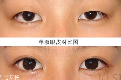 內(nèi)雙怎么變成雙的 內(nèi)雙怎么變外雙小妙招 內(nèi)雙怎么變成雙的 內(nèi)雙怎么變外雙小妙招
