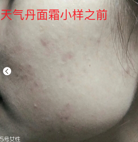 whoo后的天氣丹效果怎么樣 敏感肌也可以放心使用 whoo后的天氣丹效果怎么樣 敏感肌也可以放心使用