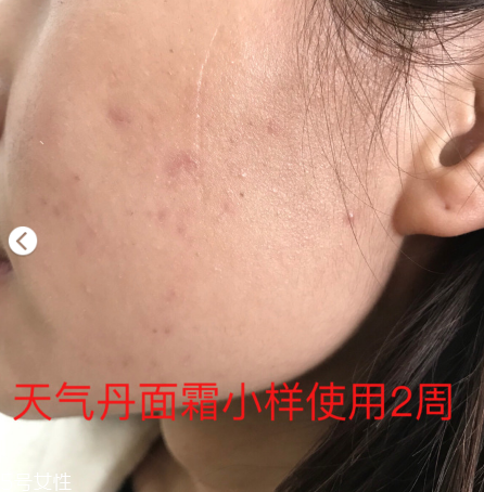 whoo后的天氣丹效果怎么樣 敏感肌也可以放心使用 whoo后的天氣丹效果怎么樣 敏感肌也可以放心使用